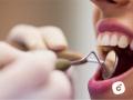 Limpieza-dental-Osuna